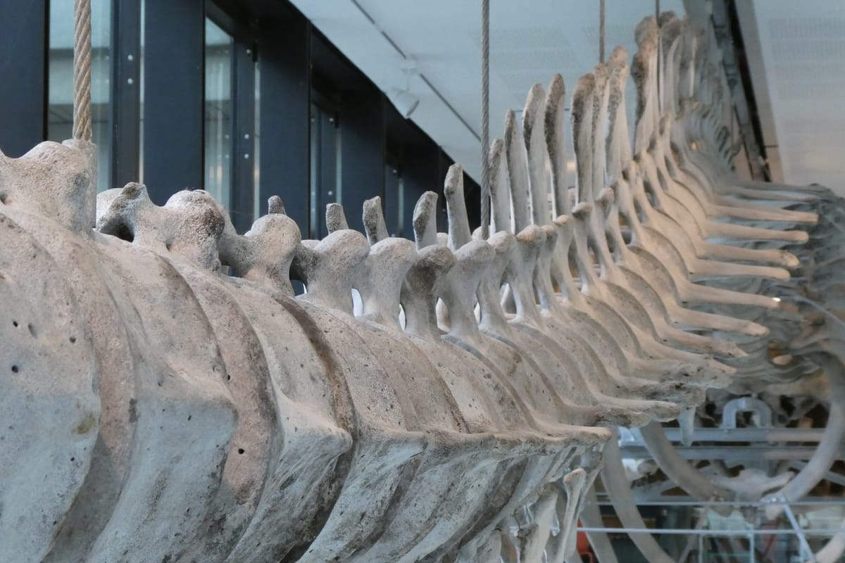 Vertebrae and ribs, from underneath